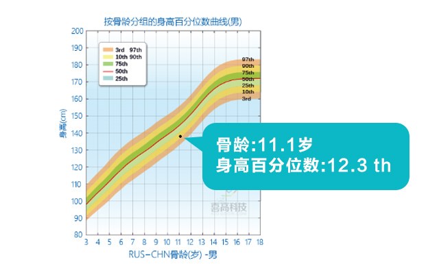 判斷孩子的高矮？這3點沒搞清楚會后悔！_05.jpg