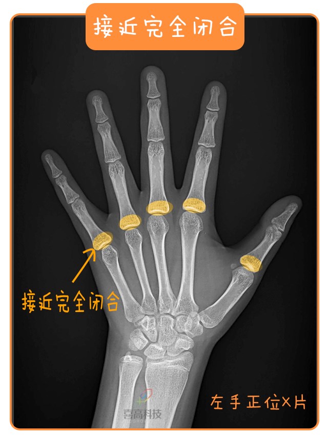 重啟骨骺線~你看起來很誘人！_13.png