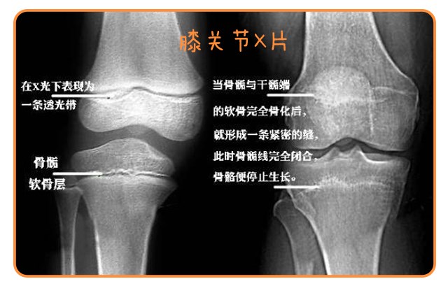 重啟骨骺線~你看起來很誘人！_14.png