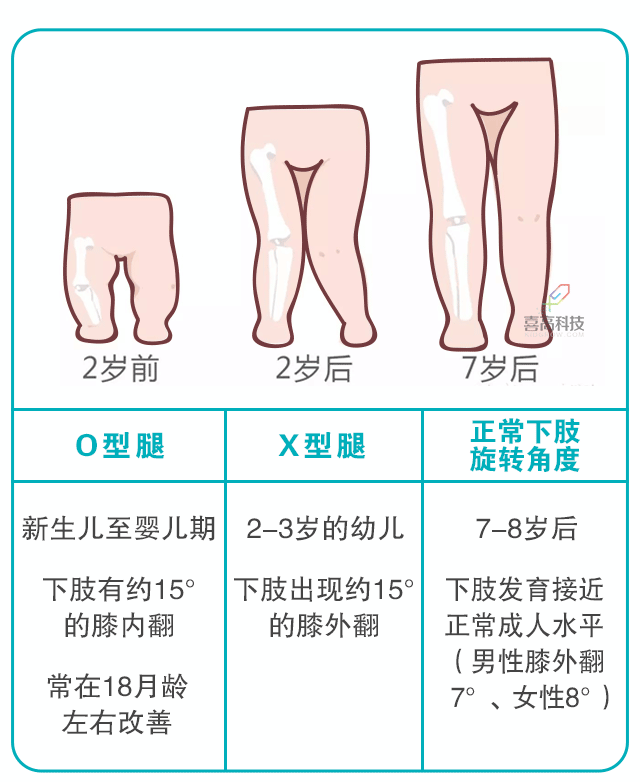 寶寶身長腿短，長大會是矮個子嗎？_03.gif
